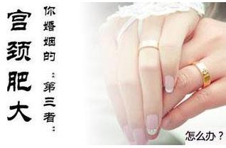 �����ʴ����ƹ�����Ҫע��ʲô��