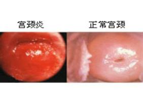 �������ƹ���������Щ����?